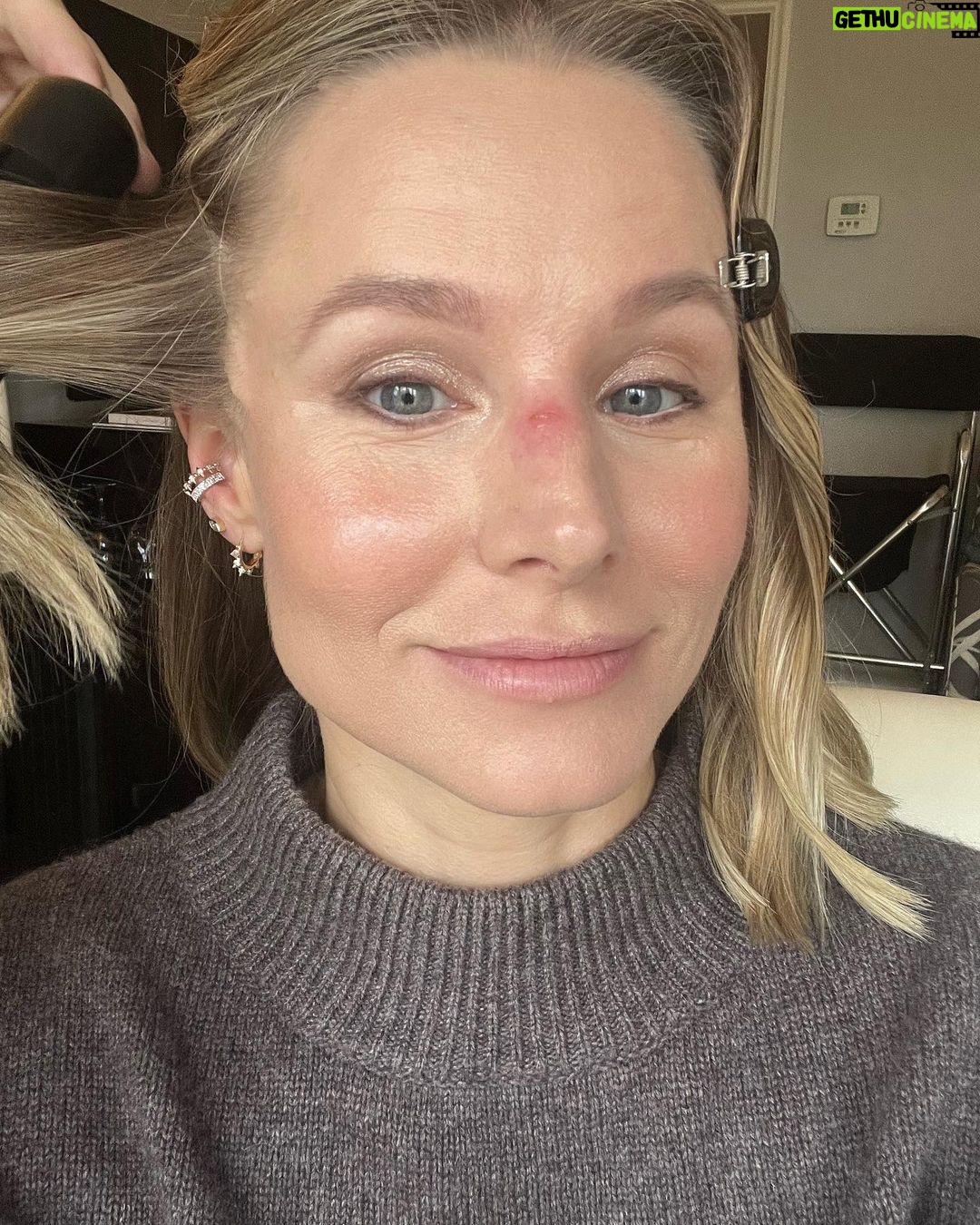 Kristen Bell Instagram - Minor jujitsu injury…took some teeth to the nose. Will recover. You should see the other guy!!!! (she is 8, the fruit of my loins, and has big, sharp, buck teeth.)