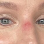 Kristen Bell Instagram - Minor jujitsu injury…took some teeth to the nose. Will recover. You should see the other guy!!!! (she is 8, the fruit of my loins, and has big, sharp, buck teeth.)