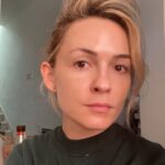 Lindsey Gort Instagram - warning: no filter or make-up was used during the taking of this photo ☠️ filming with full make-up AND wearing a mask has wreaked havoc on my sensitive skin. i am so thankful to @gabriella_fnp at @facileskin for helping me get some glow back 🌞 i tried their PRP+microneedling treatment and after a few days of peeling, i could see a much smoother texture and dewy appearance. i know it takes a few treatments to *really* see the long term benefits and i can’t wait til i can go back. highly recommend if you are struggling with your skin and need some pampering 🙌🏻🙌🏻 #facileskin Facile