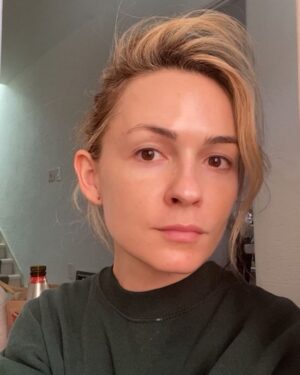 Lindsey Gort Instagram - warning: no filter or make-up was used during the taking of this photo ☠️ filming with full make-up AND wearing a mask has wreaked havoc on my sensitive skin. i am so thankful to @gabriella_fnp at @facileskin for helping me get some glow back 🌞 i tried their PRP+microneedling treatment and after a few days of peeling, i could see a much smoother texture and dewy appearance. i know it takes a few treatments to *really* see the long term benefits and i can’t wait til i can go back. highly recommend if you are struggling with your skin and need some pampering 🙌🏻🙌🏻 #facileskin