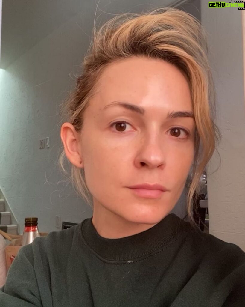 Lindsey Gort Instagram - warning: no filter or make-up was used during the taking of this photo ☠️ filming with full make-up AND wearing a mask has wreaked havoc on my sensitive skin. i am so thankful to @gabriella_fnp at @facileskin for helping me get some glow back 🌞 i tried their PRP+microneedling treatment and after a few days of peeling, i could see a much smoother texture and dewy appearance. i know it takes a few treatments to *really* see the long term benefits and i can’t wait til i can go back. highly recommend if you are struggling with your skin and need some pampering 🙌🏻🙌🏻 #facileskin Facile