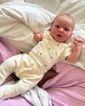 Liz Trinnear Instagram - One month of Nico and we couldn’t be more in love and in awe of how much she’s grown. Our world has forever changed for the better with her in it. 

We found out about Nico’s limb difference at our 20 week ultrasound. I will never forget the moment and the way the room was spinning, or the feeling of Nat’s hand squeezing mine. I don’t think anyone can prepare you for a moment like that. 
Nico’s limb difference results from an unavoidable, undetectable occurrence that happens at around 6 weeks into fetal development where the limb stops growing. 

After meeting with a team of doctors and medical staff, there is one thing we are sure of - these kids are magical little beings who come into the world and show us their way, with happiness, strength and courage. They excel at “figuring it out.”

Bit by bit we told our family and friends about Nico’s arm throughout the rest of our pregnancy. Each person showed us an immense amount of love and support and told us “we can’t wait to meet her” - we felt the same way. 

I remember texting a friend, “how can I be so proud of someone I haven’t even met yet?” And in all honesty, I have always been and I will always be so proud of her. Every milestone she passes, big or small.

Growing up with a “difference” is something I am familiar with. I have Epidermolysis Bullosa Simplex, a condition that causes painful blistering of the skin. Thankfully Nico will never have the pain of EB, but she will face some obstacles. 

My difference taught me to look at the world with a kinder eye - you never know what someone is going through. My dream for Nico is that she never feels one ounce of limitation, and that she chases after anything she wants to do and achieve. One thing is for sure: she will do whatever she sets her mind to. 

Our Nico has been the special soul we’ve been waiting for for a long time. She’s perfect just the way she is and I cannot wait to watch her take on this world and show us that nothing will ever stop her. 💫🌈💕 #limbdifference #limbdifferenceawareness
