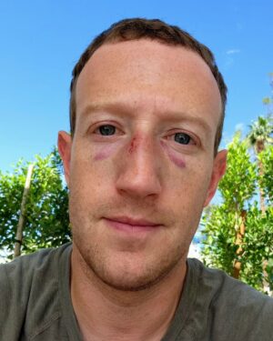 Mark Zuckerberg Instagram - Sparring got a little out of hand. May need to update my avatar 🤣