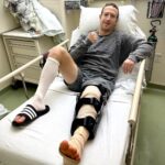 Mark Zuckerberg Instagram – Tore my ACL sparring and just got out of surgery to replace it. Grateful for the doctors and team taking care of me. I was training for a competitive MMA fight early next year, but now that’s delayed a bit. Still looking forward to doing it after I recover. Thanks to everyone for the love and support.