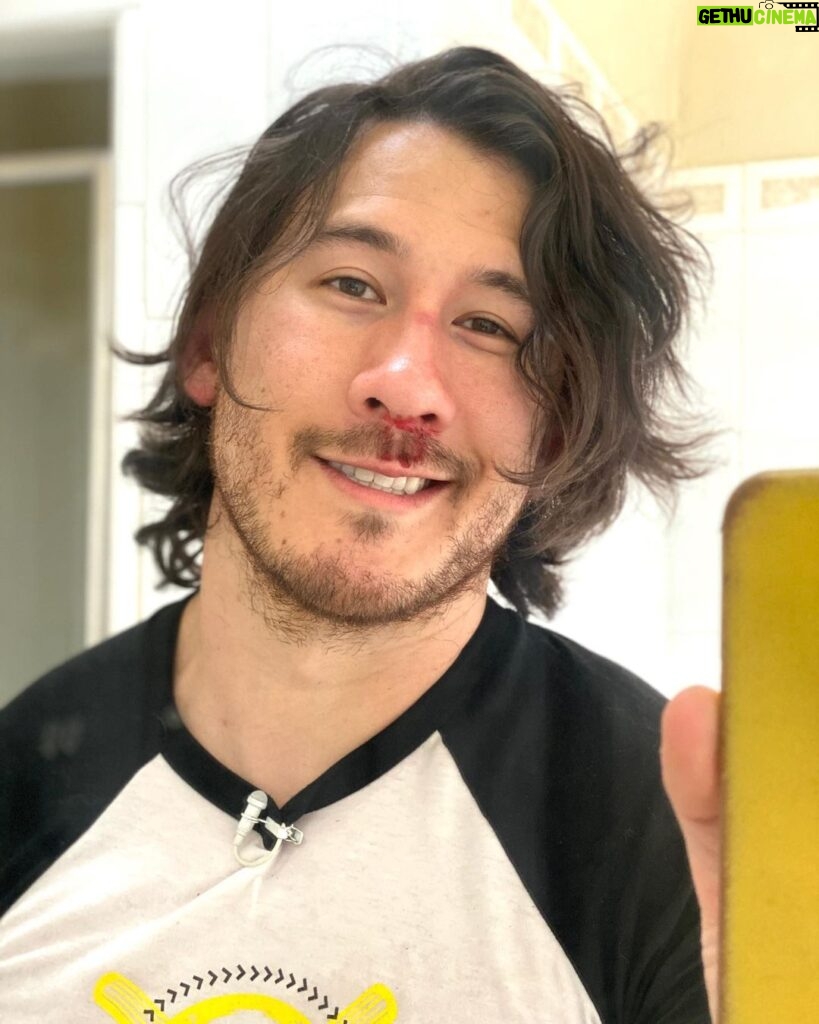 Markiplier Instagram - Broke my nose again. 2nd time this week. Going for the high score.