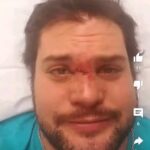 Martin Casaus Instagram - You wanna know how I got these scars??? A souvenir from Mexico from my late friend LA Parka. RIP amigo. Sometimes you just want to be a bull and maime some people #MartinCasaus #McVenture #martythemoth #ProWrestling #wrestlingcommunity #ProWrestling #Mcfitness #Health #Wellness #Fitness #Healthy #Workout #SaltLakeCity #SLC #VisitSaltLake #Utah #SaltLake #UtahGram #UtahTravel #SLCCreativeCommunity #SLCContentCreators #utahcontentcreator #luchalibre #mexico #luchalibreaaa Salt Lake City, Utah