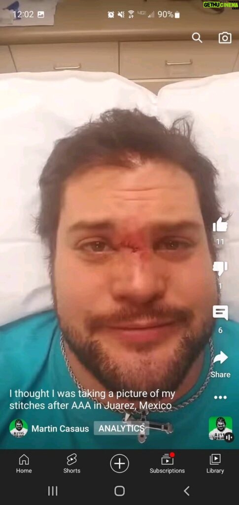 Martin Casaus Instagram - You wanna know how I got these scars??? A souvenir from Mexico from my late friend LA Parka. RIP amigo. Sometimes you just want to be a bull and maime some people #MartinCasaus #McVenture #martythemoth #ProWrestling #wrestlingcommunity #ProWrestling #Mcfitness #Health #Wellness #Fitness #Healthy #Workout #SaltLakeCity #SLC #VisitSaltLake #Utah #SaltLake #UtahGram #UtahTravel #SLCCreativeCommunity #SLCContentCreators #utahcontentcreator #luchalibre #mexico #luchalibreaaa Salt Lake City, Utah