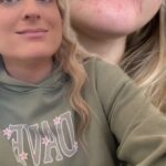Meghan Trainor Instagram - Make up covers it but its itchy and dry. If anyone has tips and suggestions plz lemme know. Also this banger drops TONIGHT! @samfischer #perioraledermatitis #34weekspregnant #alright