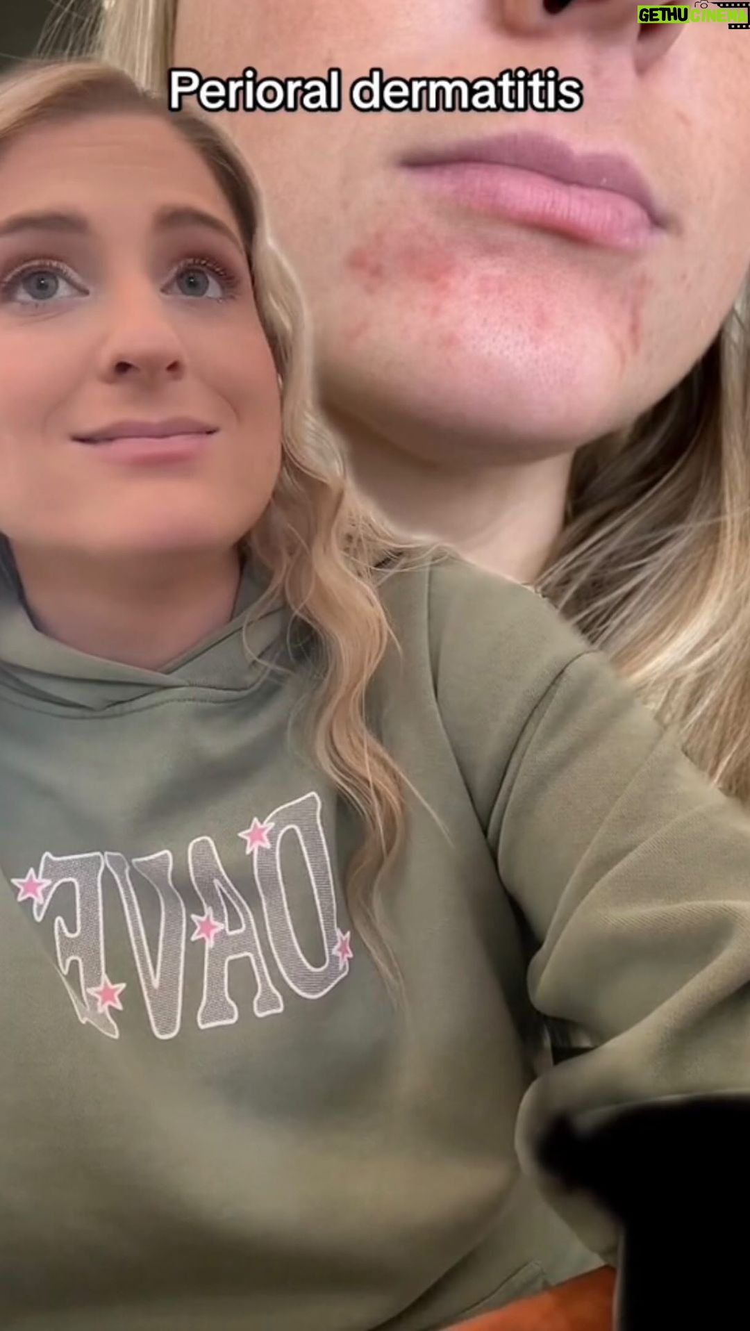 Meghan Trainor Instagram - Make up covers it but its itchy and dry. If anyone has tips and suggestions plz lemme know. Also this banger drops TONIGHT! @samfischer #perioraledermatitis #34weekspregnant #alright