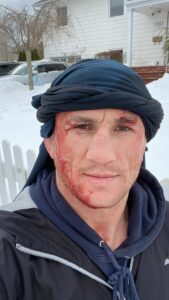 Merab Dvalishvili Instagram - In Georgia we have an expression ... It is better to break your head than break your reputation. 4 years ago, unfortunately I did both 🤣🤦‍♂️! But I am not ashamed .. I still laugh at myself. Warning: #donottrythisathome