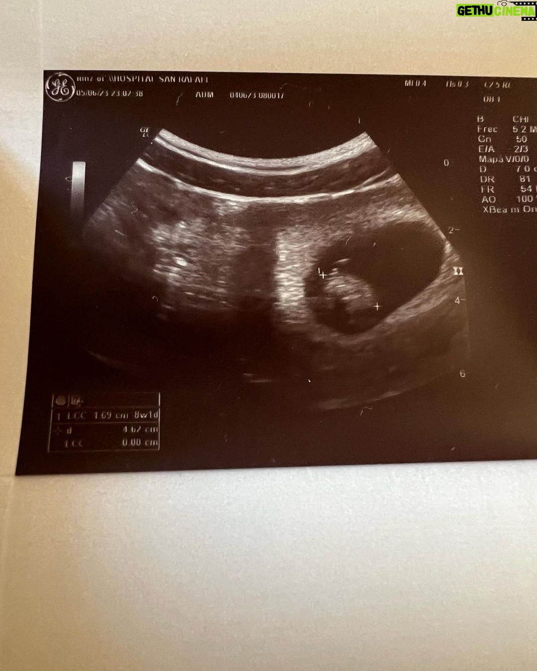 Miguel Herrán - 1.4 Million Likes - Bueno.. poco más puedo decir.
Las imágenes hablan por sí solas..
esta es mi familia.
Y es lo que más quiero en este mundo.
@celiapedraza_ me ha hecho el mayor regalo de mi vida.. vamos a ser padres.
Todavía no sabemos nada, solo que de momento está todo perfecto y que tenemos una ilusión que nos cuesta mucho gestionar.
🌻🥑🦋🦔🌙❤️