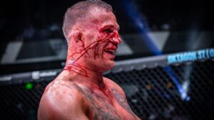 Miloš Petrášek Instagram - Připravil jsem se, bojoval a odcházím s hlavou nahoře.
Byl to těžký zápas, kdy jsem ve druhém kole nakoupil dost úderů a do třetího šel nahulenej, jako ještě nikdy a přes to jsem to nechtěl vzdát.

V zápase jsem udělal chyby, které mě štvou, ale s tím už teď nic neudělám. 
Věřím, že ze mě Stephan udělal zase o něco lepšího zápasníka pro příště. 

Tahle příprava byla náročná z každého pohledu a za ten finanční děkuji sponzorům, kteří se mnou drží ať už se svítí a nebo je zataženo. 
@parkaficko 
@ondra_kuca87 
@ivarcs1992 
@jiri_bejcek 
@matesmuller76 
@boudaujamesona 
HB group
Díky🙏🏼

#me#man#mma#fight#respect