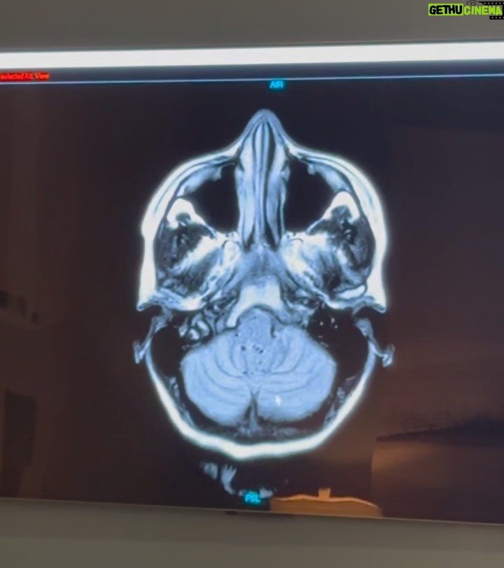 Miranda Kerr Instagram - Health is wealth! I am so grateful for the opportunity to visit @prenuvo yesterday. They are transforming the medical space by providing proactive scans to advance early detection, prevent disease, and help you make informed decisions about your health. The team was incredibly kind and knowledgable. We did a full body scan and confirmed everything from my brain to my liver is healthy. I left their office with so much peace of mind. Let this be your reminder to schedule your annual appointments and take care of your body 💙