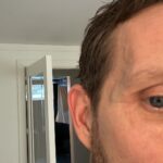 Morten Ramm Instagram - Når noen sier at de «har gått på en dør bare», så har de mest sannsynlig blitt banka opp og ikke gått på en dør, for jeg gikk hardt på den døra istad og det synes nesten ikke. Så om noen sier at bare har gått på døra, men har en klokke rundt en av gluggene, så stol på magkänslan her og ikke tenk at det faktisk stemmer. Kanskje stille noen kontrollspørsmål, og høre litt om hvordan hen har det i heimen.