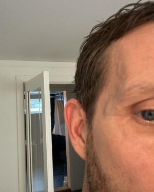 Morten Ramm Instagram - Når noen sier at de «har gått på en dør bare», så har de mest sannsynlig blitt banka opp og ikke gått på en dør, for jeg gikk hardt på den døra istad og det synes nesten ikke. Så om noen sier at bare har gått på døra, men har en klokke rundt en av gluggene, så stol på magkänslan her og ikke tenk at det faktisk stemmer. Kanskje stille noen kontrollspørsmål, og høre litt om hvordan hen har det i heimen.