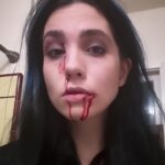 Nadezhda Tolokonnikova Instagram - never try to kiss the dog you don't know ------ 6 stitches