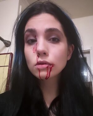 Nadezhda Tolokonnikova Instagram - never try to kiss the dog you don't know ------ 6 stitches