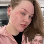 Nikkie de Jager Instagram - Where would I be without my beloved @erborian_usa CC Red Correct? 🥰 the ultimate product for my red skin! #erborianusa #ccredcorrect ( a d )
