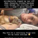 Our Lady J Instagram - 5 years ago today, I made the mistake of performing at Pride only 3 weeks after having facial feminization surgery. I accidentally ripped my ear off when changing clothes because even though the stitches were out, I hadn’t quite healed. May this be a cautionary Pride tale for my trans siblings 😝 And thank you to the doctor who allowed me to hold my dog throughout this traumatic event. #happypride Portland Oregon