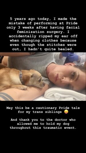 Our Lady J Instagram - 5 years ago today, I made the mistake of performing at Pride only 3 weeks after having facial feminization surgery. I accidentally ripped my ear off when changing clothes because even though the stitches were out, I hadn’t quite healed. May this be a cautionary Pride tale for my trans siblings 😝 And thank you to the doctor who allowed me to hold my dog throughout this traumatic event. #happypride