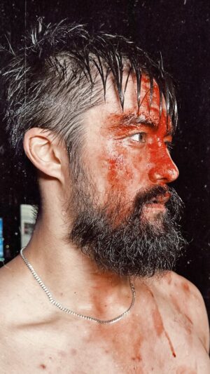 Paul Gruber Instagram - Portrait of violence.

#bloodandguts #aewdynamite #aew