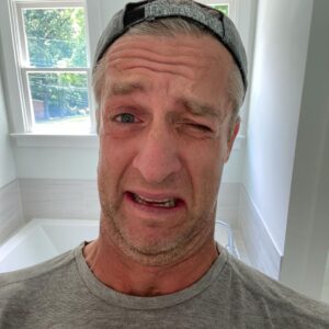 Penn Holderness Instagram - So here’s something fun to do! Step one: put on sunscreen. Step two: put on your contacts without washing your hands. I’m a friggin idiot.  Update-  Adding insult t CHINjury. Now I lost the lens and I’m in pain.  And I don’t have any more at that prescripCHIN. #doublechinforthewin