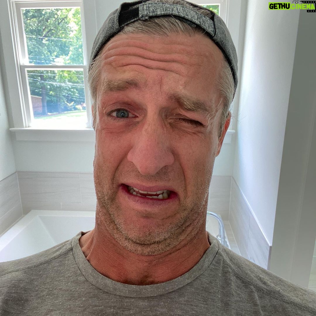 Penn Holderness - 1.5K Likes - So here’s something fun to do! Step one: put on sunscreen. Step two: put on your contacts without washing your hands. I’m a friggin idiot. Update- Adding insult t CHINjury. Now I lost the lens and I’m in pain. And I don’t have any more at that prescripCHIN. #doublechinforthewin