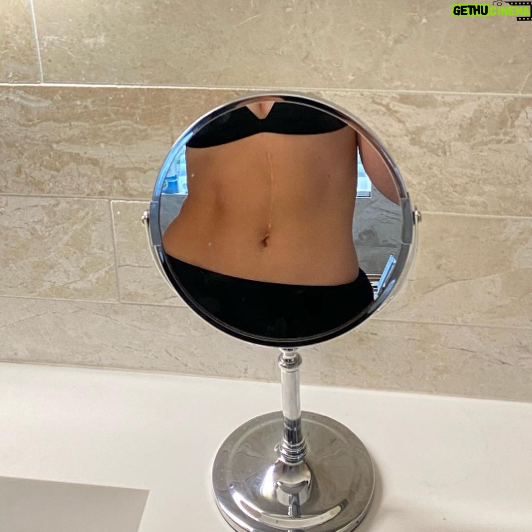 Perrie Edwards Instagram - 𝐌𝐎𝐎𝐃 & 𝐈𝐥𝐲 icle scar