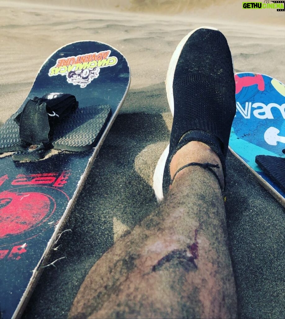 Raúl Coronado Instagram - Parte de el juego !!😎😎🏝🏝🏝 #auch #miramamasinpierna #gozando #sandboarding #mexico🇲🇽