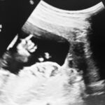 Raige Instagram - Colpito dritto al cuore baby 👉🏻 Papà è già solo tuo per sempre ❤️‍🔥 Turin, Italy