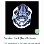 Ricki Lake Instagram - So guys, exactly a month ago I went in for my @prenuvo mri scan. And my results are in! I will admit, I was a little nervous after learning that 1 in 20 people have significant findings turn up. Elated to report back that there was no major issues with this 54 year old! The report itself is so extensive and so thorough. The nurse practitioner talked me through my entire scan results. Overall this was an amazing experience, and I will be back in two years to do a follow up as a preventative measure. So grateful for this technology! I highly recommend you make your appointment for your own scan. Use this promo code : prenuvo.com/Ricki for $300 off. Prenuvo uses advanced MRI to perform a full body scan able to detect solid cancerous tumors at stage 1 and around 500 other conditions (including aneurysms, spine herniations, fatty liver disease). The vast majority of the cancers and medical conditions found are at an early stage, where treatment is easier and much more likely to be successful. Unlike other screening mechanisms, Prenuvo does not use radiation or contrast, making it a safe preventative screening tool. On average, Prenuvo gives a potentially life-saving diagnosis to 1/20 people. Many of these diagnoses occur in patients that are asymptomatic. Thank you @prenuvo I am relieved and grateful. #prenuvo #sponsored #preventativehealth #health #moderntechnology