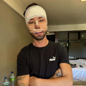 Rico Melquiades Instagram - Ontem passei por uma grande transformação.
Corre para os stories.