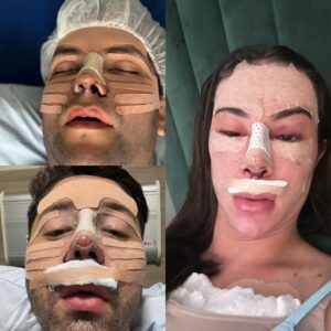 Rico Melquiades Instagram - Se uma cair as três caem.