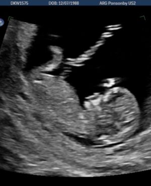 Riley Elliott Instagram - I’m going to be a dad! 

So stoked to have got to a point in this journey where Amber and I feel confident enough to share our joy, because the biggest thing learnt so far, has been the realities behind trying. I feel like I have a new found sensitivity, likely in part to aid in becoming a father but also because I have felt so powerless in the hurdles my incredible wife has overcome. Miscarriages are things I had never heard much about, but when you are unlucky and experience them, you realise you are not alone and in fact so many friends have run the same road at times. For those who haven’t had to, I do not mean to take anything away from your experiences, I imagine and will likely see that creating a human that then entirely depends on you is hard enough. This will hopefully be our next chapter. But up to this point all I can say is that women are so incredibly strong, so driven, and so capable. It’s really hard when you as a guy feel like the car driving alongside the railway tracks and it’s starting to sway. What I’ve learned so far is all you can do is be a rock of support and tell them that everything will be alright. 
Seeing tears rush from my wife at our half way scan, being happy tears, made the journey all worth it. To all those mums and ones to be, you are amazing. None of us would be here without you. To all those dads, I can’t wait for dad group chat lol. 
My next big task before the baby comes is to figure out how I juggle my existing 6year old wolf who never likes sharing the back seat!