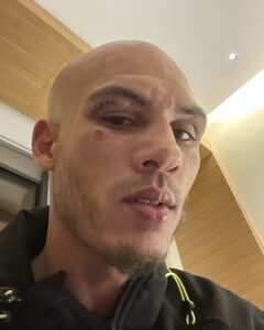Samy Sana Instagram - Bonsoir, à tous je suis vraiment désolé pour ce combat, je n’ai pas eu le temps de m’exprimer. Un highkick m’a touché à l’œil, je ne voyais plus rien! Le destin! c’est pour ça que j’ai arrêté. Désolé à tous! Merci pour tout! Je reviendrai encore plus fort croyez moi.