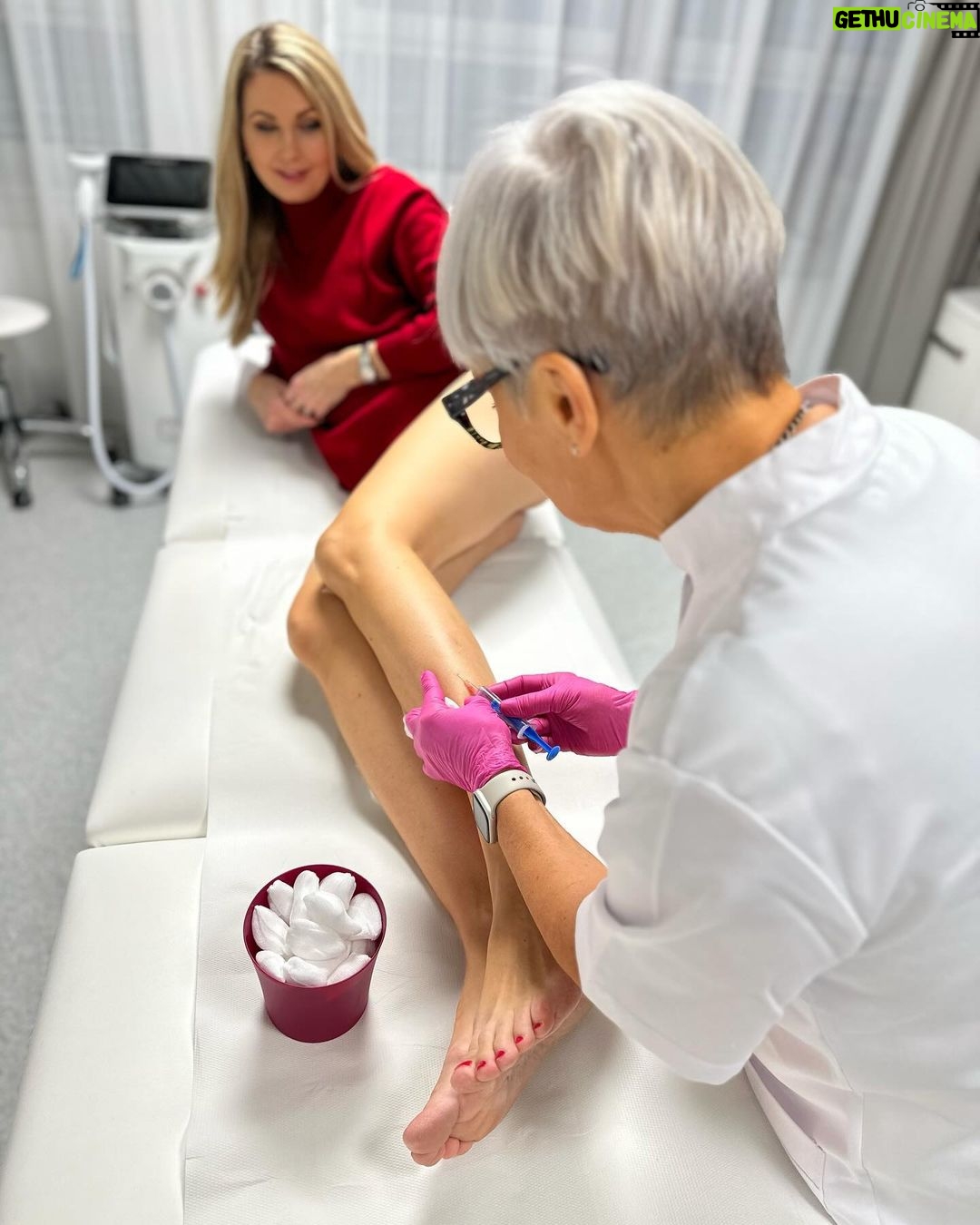 Sandra Parmová Instagram - Jestli máte rádi okamžitý zkrášlovací WOW efekt, mrkněte do galerie 💉🙀 Na sklerotizaci, tedy “vymizíkování” křečových žil jsem už byla, ale někdy to bývá trochu boj s větrnými mlýny😝 A zrovna u mě bylo potřeba zákrok zopakovat, protože metličkové žilky vypadaly tak trochu jako modřiny 🙈 Pokud na křečové žíly také trpíte, teď v zimě je nejlepší období to pořešit, protože je pak potřeba ještě 4 týdny nosit kompresní punčošky☺️ Ale to se zrovna v tomhle počasí dost hodí ❄️🌡️😅 A za ty krásné nožky to stojí 💃🏼🤩 Děkuji opět za skvělou péči, @medicomclinic. Možná se to z videí nezdá, ale rozhodně to nějak dramaticky nebolí. Jen to trochu štípne 💉😉 A paní doktorka @sabina.sellner umí trefit opravdu i tak drobné žilky, že jsem tomu ani sama nevěřila😍 Kdyby vás cokoliv zajímalo, klidně se v komentářích zeptejte. Můžeme tady sdílet třeba i vaše zkušenosti. ❤️ #krecovezily #zily #sklerotizace #medicomclinic #brno #vinicni #medicomgirl #letoseblizi #nejlepsizmenyjsoutyklepsimu #krasnenohy Brno, Czech Republic