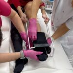 Sandra Parmová Instagram - Jestli máte rádi okamžitý zkrášlovací WOW efekt, mrkněte do galerie 💉🙀 Na sklerotizaci, tedy “vymizíkování” křečových žil jsem už byla, ale někdy to bývá trochu boj s větrnými mlýny😝 A zrovna u mě bylo potřeba zákrok zopakovat, protože metličkové žilky vypadaly tak trochu jako modřiny 🙈 Pokud na křečové žíly také trpíte, teď v zimě je nejlepší období to pořešit, protože je pak potřeba ještě 4 týdny nosit kompresní punčošky☺️ Ale to se zrovna v tomhle počasí dost hodí ❄️🌡️😅 A za ty krásné nožky to stojí 💃🏼🤩 Děkuji opět za skvělou péči, @medicomclinic. Možná se to z videí nezdá, ale rozhodně to nějak dramaticky nebolí. Jen to trochu štípne 💉😉 A paní doktorka @sabina.sellner umí trefit opravdu i tak drobné žilky, že jsem tomu ani sama nevěřila😍 Kdyby vás cokoliv zajímalo, klidně se v komentářích zeptejte. Můžeme tady sdílet třeba i vaše zkušenosti. ❤️ #krecovezily #zily #sklerotizace #medicomclinic #brno #vinicni #medicomgirl #letoseblizi #nejlepsizmenyjsoutyklepsimu #krasnenohy Brno, Czech Republic
