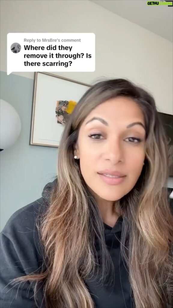 Sangita Patel Instagram - Probably the one question I’ve been asked consistently and it’s a good one 🥰 No scar on the neck because I had the Transoral Endoscopic Thyroidectomy Vestibular Approach (TOETVA) to get out the lump. I hope this helps if you are on a similar journey ❤️ And a huge thank you to @uhntoronto for being my angel ❤️ Coming up on my journey in the next few months Another Surgery… Radiation (RAI)… I’ll be fine ❤️ Once I start hitting those high notes - singing ‘Let it GOOOO’ 🎵😂 You can hear it already! #TechnologyRocks #MyJourneyContinues #AFewMoreHurdles #Oncocytic #ThyroidCancer