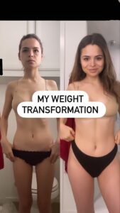 Sasha Clements Instagram - 2022 was tough but I’m proud of my progress! This is what a year of an RA flare up looks like. Muscle atrophy, weight loss, hair loss, adverse medical reactions, eyes swollen shut, level 10 pain, and lots of judgmental looks from others. I used to think this was my weakest point in life but looking back it was most definitely when I showed the most strength💪🏼 So much gratitude to @chadlanders for guiding me as I eased back into working out and modifying exercises to my needs. Each time I left the gym I felt stronger and more confident, so thank you for helping me lay a new foundation 🫶🏼 And to everyone who checked on me and sent me loving messages. Can’t tell you how impactful they were when I was in some really low places. I’m now heavier than when I started and feel like a different person. So happy my body has the weight and muscle it needs to fight for me! 2023 goal is to build more upper body strength and to continue to treat my body with the respect it deserves ❤️ If you also have an autoimmune condition or deal with chronic pain I hope this helps show you that there is light at the end of the tunnel ❤️ #bodytransformstion #autoimmunedisease #rheumatoidarthritis #chronicpain #lupus #lyme #ebv #spoonie #flareup #beforeandafter #beforeandsfterweightgain #weightgain #healing #naturalmedicine #rawarrior #chronichives #urticaria #2023goals