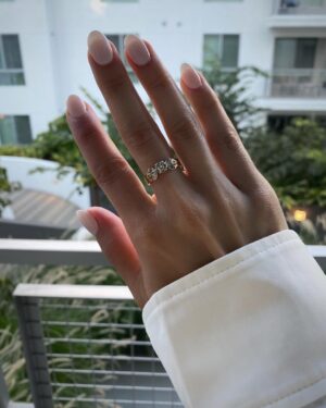 Sasha Clements Instagram - It’s easy to forget our progress! I documented my entire flare up just so I'd have references to look back on and i’m so happy I did! I couldn’t fit this ring on for almost a year (I tried every day). ⁠
⁠
This week has presented some tough challenges and even though my fingers are still sore and I can see where I’m still swollen, I’m beyond grateful for the reminder that there has been improvement!🙏🏼⁠
⁠
A little background- I was diagnosed with RA over 10 years ago. Was treated with Methotrexate and went into “remission”. Meaning my swelling and severe pain went down but I never really got better. I was still achy & sore. Had major brain fog & exhaustion to the point Corbin made me test for narcolepsy. I was always dealing with inflammation/ infections. I was constantly breaking out into rashes and hives and would be on Prednisone multiple times a year. So I was in "remission" but I wasn’t thriving - I was surviving. ⁠
⁠
When I flared up again I was once again diagnosed with RA - then Lupus - then they added Lyme. With more testing we found I had high levels of mercury & lead, high toxic exposure, activated EBV, major vitamin deficiencies, hormonal imbalances, and mitochondrial dysfunction. ⁠
⁠
I’ve been on a few different meds all with their lovely side effects🙄 Some have helped but I didn’t want to repeat the same pattern of just putting this bandaid on the pain. So here are some other things that have helped immensely!⁠ 
⁠
-Working with a functional medicine doctor & getting testing done though them. Finding a mentor to guide me. I eat ZERO processed food, sugar, gluten, dairy, legumes, nuts, caffeine. I cook all of my food at home. I’ve tried many diets - AIP, low salicylate, carnivore, paleo, vegan, pescatarian and I found the trick is to just create your own diet prescription- your body knows what it needs. I take a rainbow of supplements, upped my water intake, practice gratitude, meditation, food combining, hot & cold therapy (sauna & cold showers), fasting, breath work, stretching, exercise, juicing, a wind down routine, & get good sleep.⁠
⁠
It's a lot and wasn't achieved overnight but each layer you add will only get you closer to healing ❤️⁠
⁠