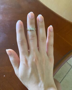 Sasha Clements Instagram - It’s easy to forget our progress! I documented my entire flare up just so I'd have references to look back on and i’m so happy I did! I couldn’t fit this ring on for almost a year (I tried every day). ⁠
⁠
This week has presented some tough challenges and even though my fingers are still sore and I can see where I’m still swollen, I’m beyond grateful for the reminder that there has been improvement!🙏🏼⁠
⁠
A little background- I was diagnosed with RA over 10 years ago. Was treated with Methotrexate and went into “remission”. Meaning my swelling and severe pain went down but I never really got better. I was still achy & sore. Had major brain fog & exhaustion to the point Corbin made me test for narcolepsy. I was always dealing with inflammation/ infections. I was constantly breaking out into rashes and hives and would be on Prednisone multiple times a year. So I was in "remission" but I wasn’t thriving - I was surviving. ⁠
⁠
When I flared up again I was once again diagnosed with RA - then Lupus - then they added Lyme. With more testing we found I had high levels of mercury & lead, high toxic exposure, activated EBV, major vitamin deficiencies, hormonal imbalances, and mitochondrial dysfunction. ⁠
⁠
I’ve been on a few different meds all with their lovely side effects🙄 Some have helped but I didn’t want to repeat the same pattern of just putting this bandaid on the pain. So here are some other things that have helped immensely!⁠ 
⁠
-Working with a functional medicine doctor & getting testing done though them. Finding a mentor to guide me. I eat ZERO processed food, sugar, gluten, dairy, legumes, nuts, caffeine. I cook all of my food at home. I’ve tried many diets - AIP, low salicylate, carnivore, paleo, vegan, pescatarian and I found the trick is to just create your own diet prescription- your body knows what it needs. I take a rainbow of supplements, upped my water intake, practice gratitude, meditation, food combining, hot & cold therapy (sauna & cold showers), fasting, breath work, stretching, exercise, juicing, a wind down routine, & get good sleep.⁠
⁠
It's a lot and wasn't achieved overnight but each layer you add will only get you closer to healing ❤️⁠
⁠
