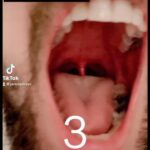 Seán McLoughlin Instagram - Can you spot the bubble in my throat?