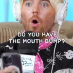 Shane Dawson Instagram - Do U have a Mouth Bump??