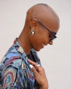 Sharon Battiste Instagram - alopecia | unrasiert | ungefiltert 🩵🩷

#alopeciaareata #kreisrunderhaarausfall #glatze