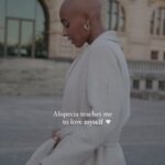 Sharon Battiste Instagram - Alopecia teaches me to love myself 🤍 #alopecia #baldwomen #alopecianbeauty #alopeciaawareness #selfportrait #selflove