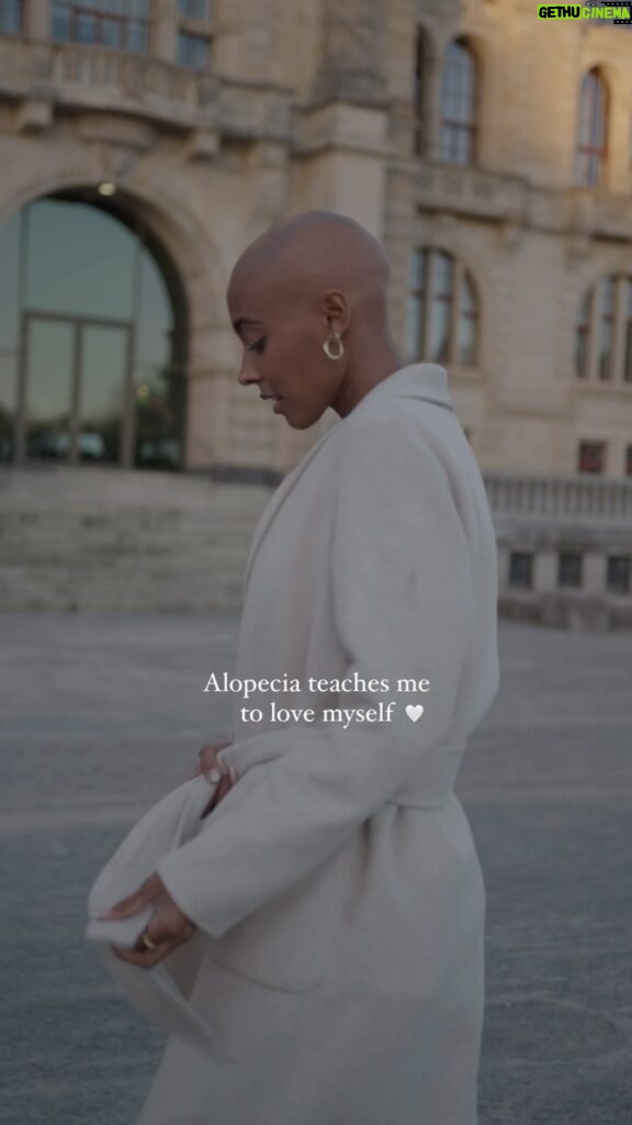Sharon Battiste Instagram - Alopecia teaches me to love myself 🤍 #alopecia #baldwomen #alopecianbeauty #alopeciaawareness #selfportrait #selflove
