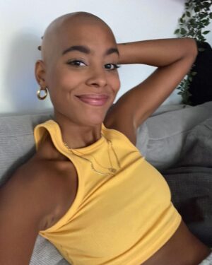 Sharon Battiste Instagram - F R E E D O M 💗 - Der ein oder andere hat mich „oben ohne“ bereits gesehen, nun aber mal ganz offiziell von mir ein Post diesbezüglich. Dieser Schritt war der wohlmöglich schwerste  aber auch wichtigste Schritt meines Lebens. Knapp 15 Jahre habe ich täglich mit #alopeciaareata zu kämpfen gehabt und nun ist Schluss! NEW ME! Ich bin so happy damit 💗 Die Rasur war wirklich der Befreiungsschlag meines LEBENS 💫  Ich bekomme von euch täglich sooo viele Nachrichten zu diesem Thema und ich verspreche euch, ich werde euch nach und nach mehr mit in diesen, meinen neuen Alltag nehmen. DANKE, für euren Support 🥺🙏🏾🖤Ich bin SPRACHLOS 🖤 - #team #glatze #alopeciaareata #newme #happy #sharonbattiste 

📸 FOTO RTL / René Lohse
