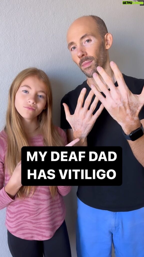 Shaylee Mansfield Instagram - Real talk… my Deaf dad has vitiligo and we had a chat about his journey. Vitiligo or not. Deaf or not. Or whatever it is. It’s time to embrace people of all kinds. 💜✨ Los Angeles, California