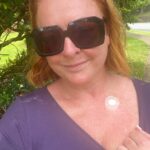 Shelly Horton Instagram - Appropriate that it’s Skin Cancer Awareness Week and I had to have a biopsy on a dodgy looking red mark. And have another burnt off my forehead. I’ll find out the results next week. I’m a Queenslander so annual skin checks are just what we do. Make sure you get checked and follow @skincheckchampions for reminders.