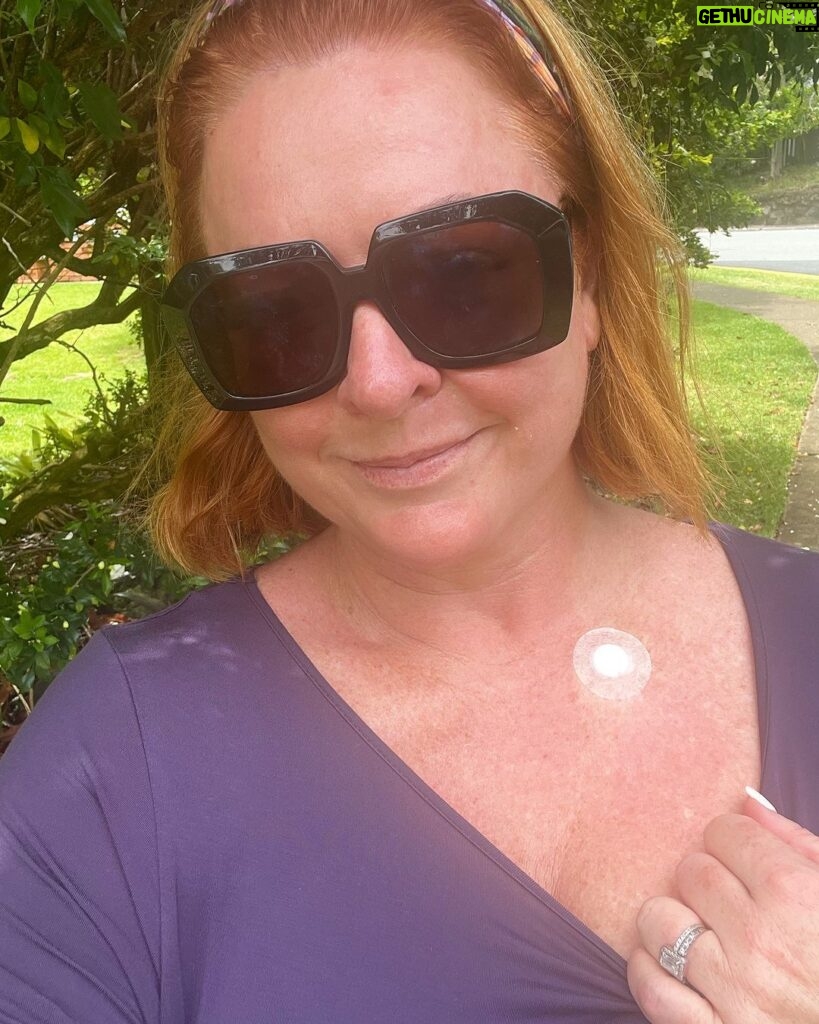 Shelly Horton Instagram - Appropriate that it’s Skin Cancer Awareness Week and I had to have a biopsy on a dodgy looking red mark. And have another burnt off my forehead. I’ll find out the results next week. I’m a Queenslander so annual skin checks are just what we do. Make sure you get checked and follow @skincheckchampions for reminders.